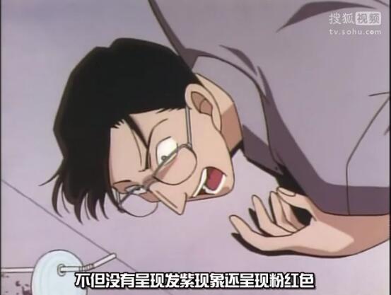 《名侦探柯南》小知识系列03，尸检篇插图12