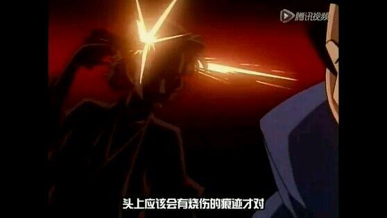 《名侦探柯南》小知识系列03，尸检篇插图2