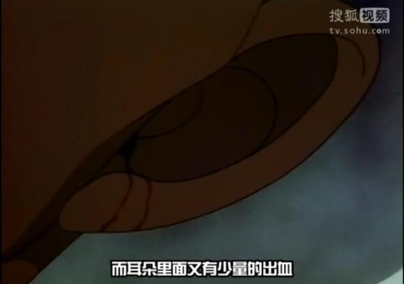 《名侦探柯南》小知识系列03，尸检篇插图11
